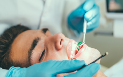 Root Canal Treatment: Myths vs Facts in Alexandra Hills
