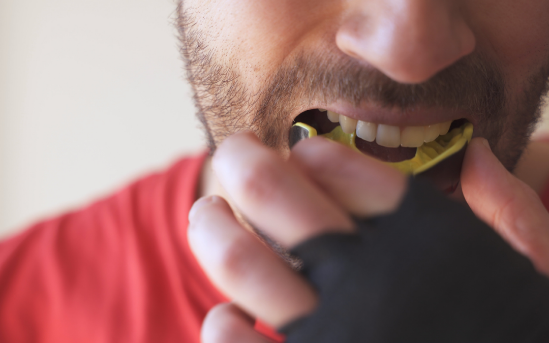 The Importance of Mouthguards for Adults and Children in Birkdale