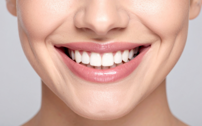 Cosmetic Teeth Whitening: Tips and Maintenance in Alexandra Hills