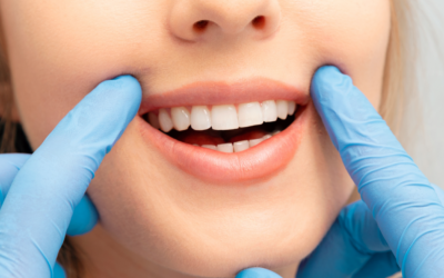 Wisdom Teeth Extraction: What to Expect in Capalaba