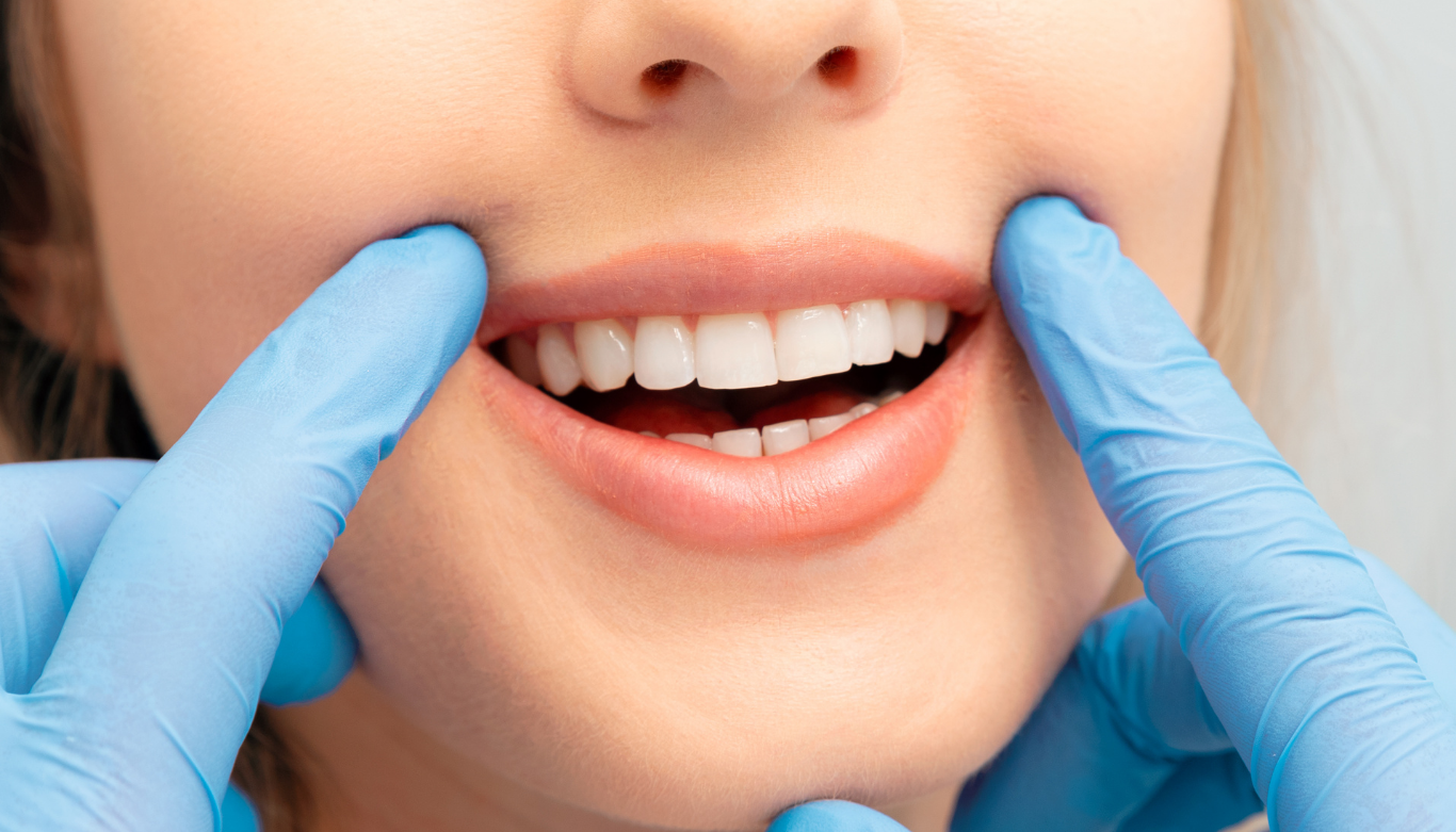 Close-up of a dental exam: gloved hands pulling the lips to reveal clean white teeth.